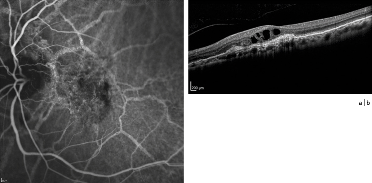 La FLUORESCÉINE, les avantages d'un traceur ULTRA performant !