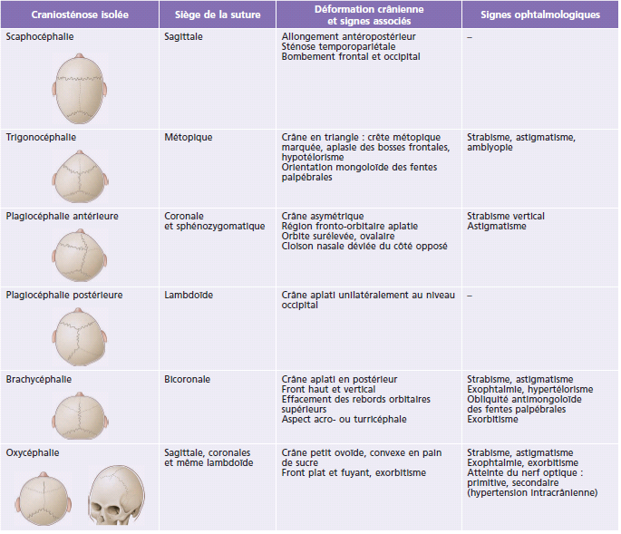 Rapport Sfo 17 Ophtalmologie Pediatrique