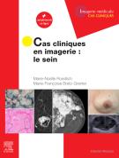 Cas cliniques en imagerie : le sein