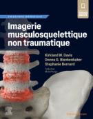 Imagerie musculosquelettique non traumatique