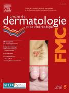 Les lymphocytes NK - Réalités thérapeutiques en Dermato-Vénérologie